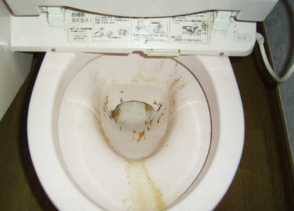 ニオイの原因となる尿石・黄ばみ・輪じみ・水アカで居心地の悪いトイレ。